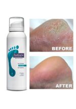 DD Cream Mousse 125ml, Footlogix - imagine 3