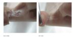 Peeling Skin Formula 125ml, Footlogix - imagine 2